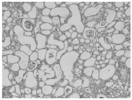 Folato Aktiboen Impurities seriearen Sarrera: ① Azido 5-metiltetrahidropteroikoaren eragina ezagutaraztea.